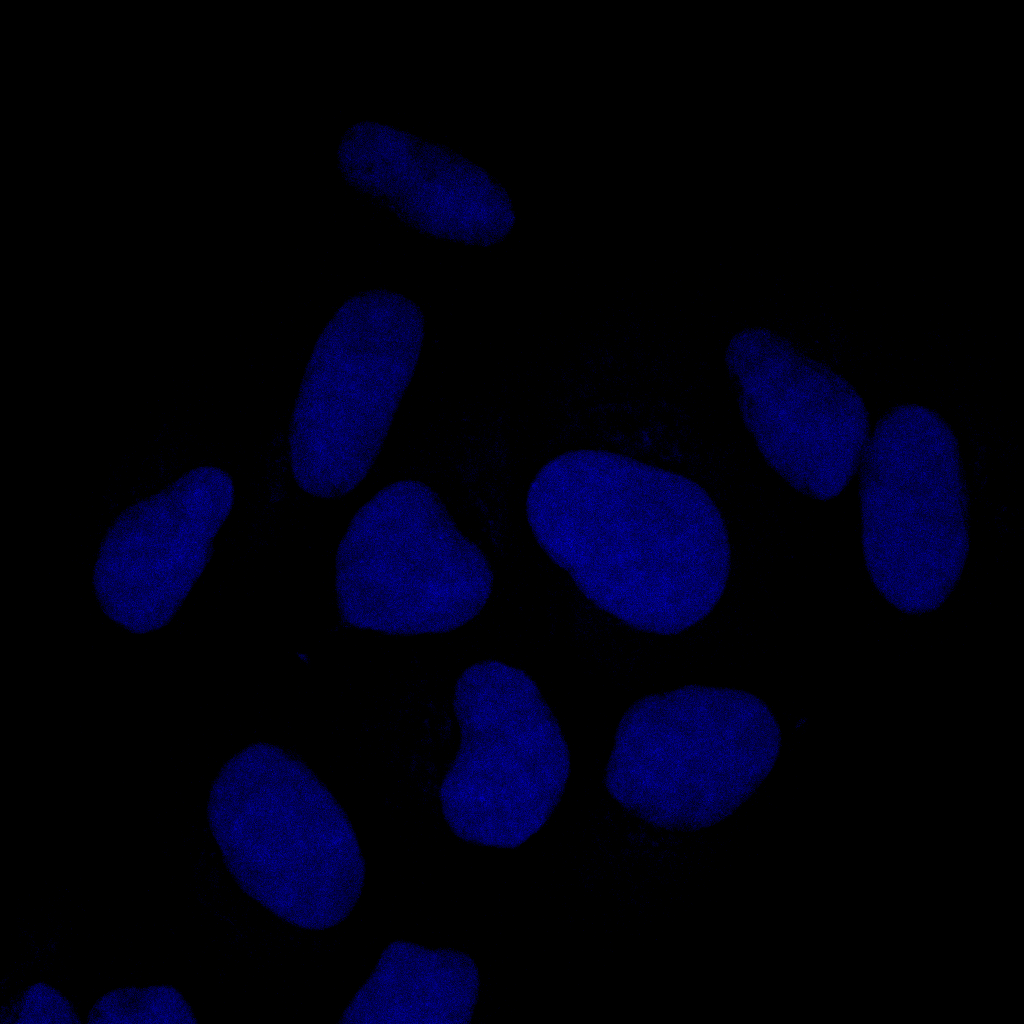 Cell nuclei (DAPI; blue)